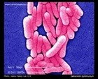 salmonella typhimurium picture